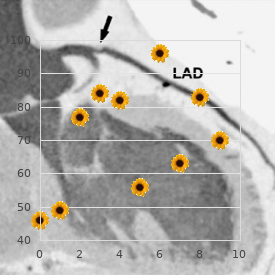 Corticobasal degeneration