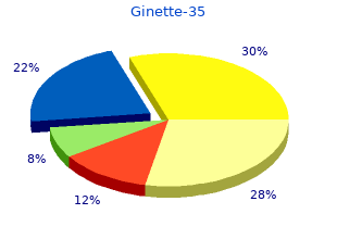 cheap ginette-35 line