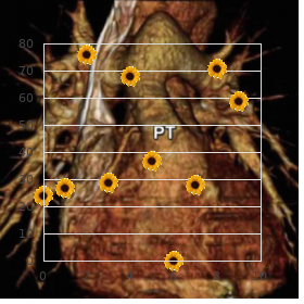 Acromesomelic dysplasia Brahimi Bacha type