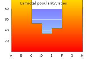 buy lamictal 100mg otc