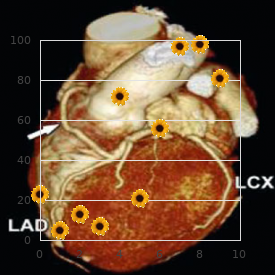 Gonadal dysgenesis Turner type