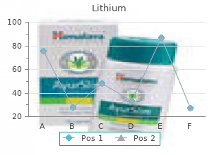 trusted 150 mg lithium