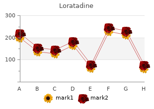 loratadine 10 mg without a prescription