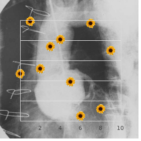 Cardiofaciocutaneous syndrome