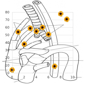 Anophthalmia microcephaly hypogonadism