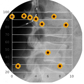 Spinal shock