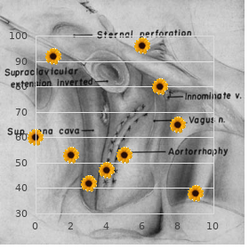 Hydrops ectrodactyly syndactyly