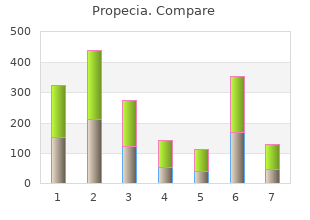 buy propecia with paypal