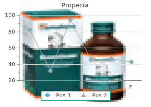 buy generic propecia 5mg on line