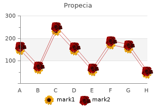 propecia 1mg otc