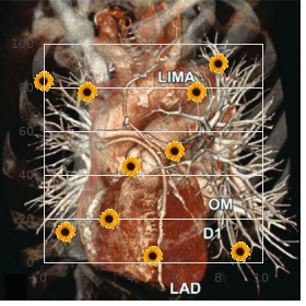 Neuroectodermal endocrine syndrome