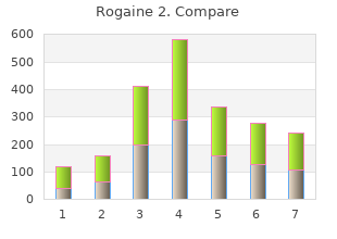 buy generic rogaine 2