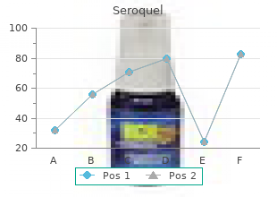 order seroquel 300mg with mastercard