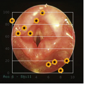 Idiopathic hypereosinophilic syndrome