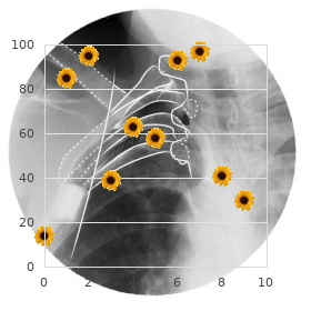 Ankyloblepharon filiforme adnatum cleft palate