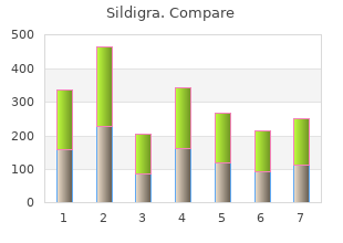 cheap 25mg sildigra fast delivery