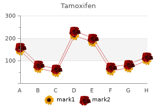 order generic tamoxifen on-line