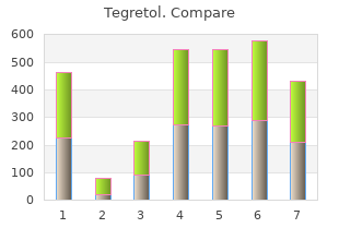 buy 100 mg tegretol mastercard