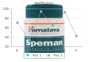 buy wellbutrin 300mg free shipping