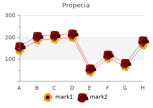 purchase propecia 5 mg without a prescription