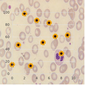 Westerhof Beemer Cormane syndrome