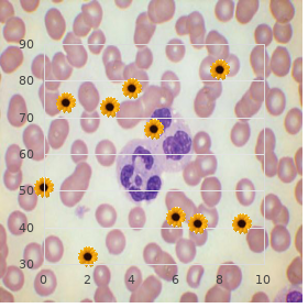 Megaloblastic anemia