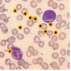 Guanidinoacetate methyltransferase deficiency