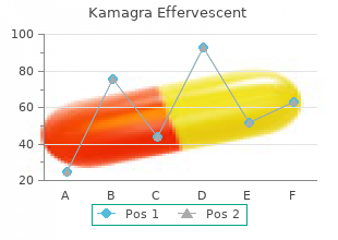 order 100 mg kamagra effervescent mastercard