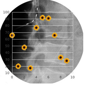 Craniomicromelic syndrome