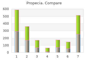 buy propecia 5 mg mastercard