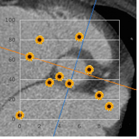 Biliary hypoplasia