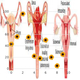 Osteolysis hereditary multicentric