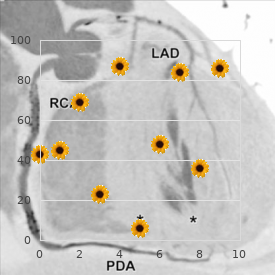 Bradykinesia