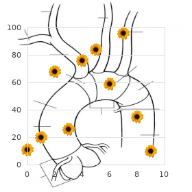 Spondylarthritis