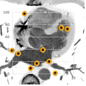 Cramer Niederdellmann syndrome