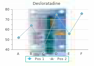 buy 5 mg desloratadine with mastercard