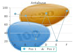 500 mg antabuse with amex