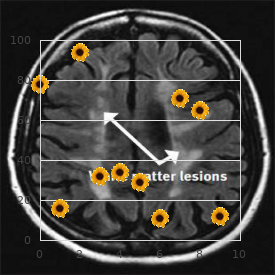 Upshaw Sch?lman syndrome
