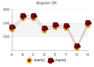 150 mg bupron sr fast delivery