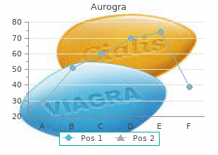 buy cheap aurogra on-line