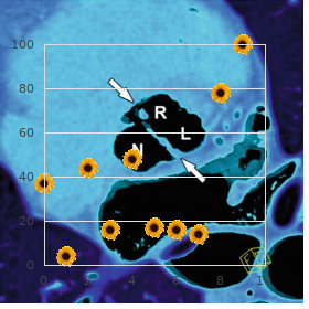 Tricho odonto onycho dermal syndrome