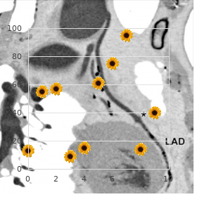 Cerebelloolivary atrophy