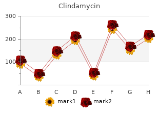clindamycin 150mg with amex