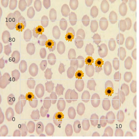 Ichthyosis congenita biliary atresia