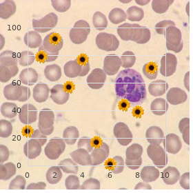 Charcot Marie Tooth disease