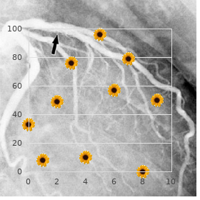 Mental retardation short stature wedge shaped epiphyses