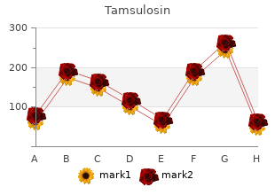 generic 0.4mg tamsulosin mastercard