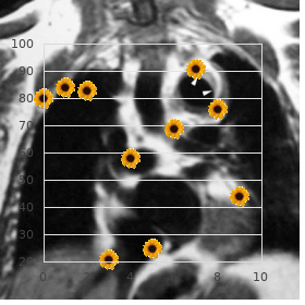 Glucose 6 phosphate dehydrogenase deficiency