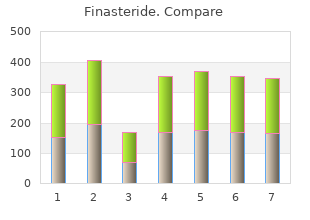 buy finasteride visa