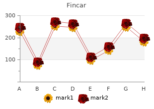 cheap 5mg fincar free shipping